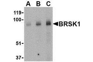 Western blot analysis of BRSK1 in human brain tissue lysate with AP30167PU-N BRSK1 antibody at (A) 0.