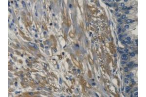 DAB staining on IHC-P; Samples: Human Prostate Tissue (TRAPPC10 anticorps  (AA 74-357))