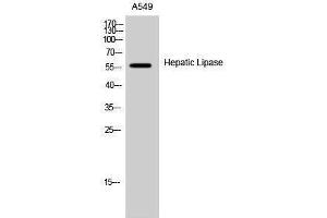 Western Blotting (WB) image for anti-Lipase, Hepatic (LIPC) (Internal Region) antibody (ABIN3175476) (LIPC anticorps  (Internal Region))