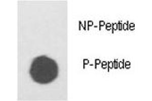 Dot blot analysis of phospho ILK antibody.