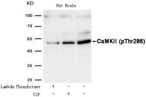 Western blot analysis of extracts from Rat brain tissue treated with Lambda Phosphotase or calf intestinal phosphatase (CIP),using CaMKII (Phospho-Thr286) Antibody. (CAMK2A anticorps  (pThr286))