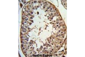 anti-Angel Homolog 1 (ANGEL1) antibody