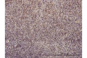 Immunoperoxidase of monoclonal antibody to RFC4 on formalin-fixed paraffin-embedded human tonsil.
