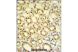 H6PD Antibody IHC analysis in formalin fixed and paraffin embedded lung tissue followed by peroxidase conjugation of the secondary antibody and DAB staining. (Glucose-6-Phosphate Dehydrogenase anticorps  (C-Term))