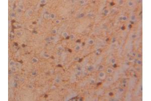 DAB staining on IHC-P; Samples: Rat Glioma Tissue (TIMP4 anticorps  (AA 40-224))