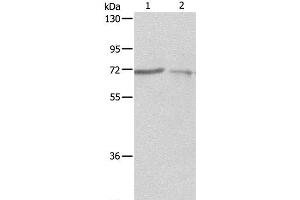 Western Blot analysis of A375 and A431 cell using SH-PTP1 Polyclonal Antibody at dilution of 1:500 (SHP1 anticorps)