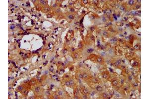 IHC image of ABIN7155245 diluted at 1:200 and staining in paraffin-embedded human liver tissue performed on a Leica BondTM system.