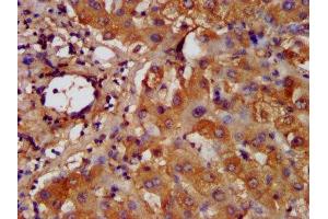 IHC image of ABIN7155245 diluted at 1:200 and staining in paraffin-embedded human liver tissue performed on a Leica BondTM system. (HAL anticorps  (AA 36-152))