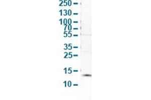 Western Blot analysis of human cell line SK-BR-3. (S100A9 anticorps  (AA 3-100))