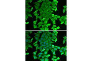 Immunofluorescence analysis of MCF-7 cells using RFFL antibody (ABIN6292254). (RFFL anticorps)