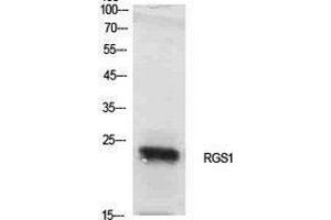 Western Blotting (WB) image for anti-Regulator of G-Protein Signaling 1 (RGS1) (Internal Region) antibody (ABIN3181413)