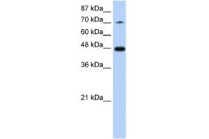 WB Suggested Anti-SF3B4 Antibody Titration:  1. (SF3B4 anticorps  (N-Term))