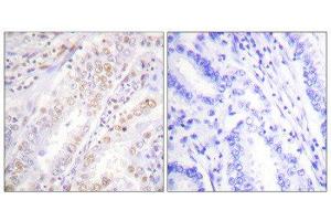 Immunohistochemistry (IHC) image for anti-X-Ray Repair Complementing Defective Repair in Chinese Hamster Cells 2 (XRCC2) (C-Term) antibody (ABIN1848896) (XRCC2 anticorps  (C-Term))
