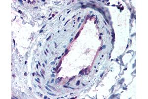 Anti-ACVR1 antibody IHC of human skeletal muscle, vessel.