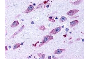 Immunohistochemical staining of Brain (Neurons and glia) using anti- DRD4 antibody ABIN122473 (DRD4 anticorps  (C-Term))