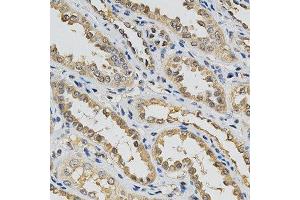 Immunohistochemistry of paraffin-embedded human kidney using EIF4E antibody at dilution of 1:200 (x400 lens)