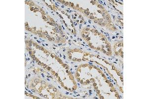 Immunohistochemistry of paraffin-embedded human kidney using EIF4E antibody at dilution of 1:200 (x400 lens) (EIF4E anticorps  (AA 1-100))