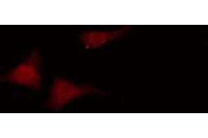 ABIN6274138 staining HuvEc cells by IF/ICC.