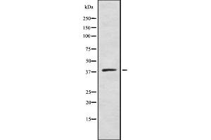 Western blot analysis of DHHC-9 using COLO205 whole cell lysates