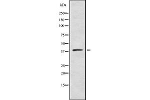 Western blot analysis of DHHC-9 using COLO205 whole cell lysates (ZDHHC9 anticorps  (C-Term))
