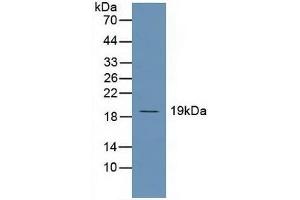 Detection of UBE2C in Human Hela Cells using Polyclonal Antibody to Ubiquitin Conjugating Enzyme E2C (UBE2C)