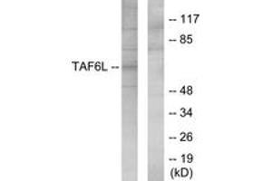 Western blot analysis of extracts from 293 cells, using TAF6L Antibody. (TAF6L anticorps  (AA 31-80))