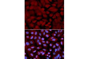 Immunofluorescence analysis of U2OS cell using OGT antibody. (OGT anticorps)