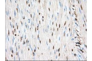 Image no. 6 for anti-Proto-Oncogene Pim-2 (Serine Threonine Kinase) (PIM2) antibody (ABIN1500220)