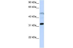 WB Suggested Anti-EIF3G Antibody Titration:  0. (EIF3G anticorps  (Middle Region))