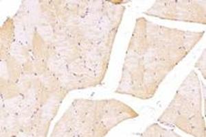 Immunohistochemistry analysis of paraffin-embedded rat skeletal muscle using,TTL (ABIN7076048) at dilution of 1: 4000