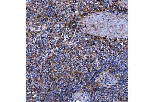 IHC analysis of Septin 11/SEPTIN11 using anti-Septin 11/SEPTIN11 antibody (ABIN7602925). (Septin 11 anticorps  (C-Term))