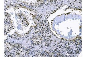 IHC analysis of FOXK1 using anti-FOXK1 antibody (ABIN7600295). (Foxk1 anticorps  (AA 175-671))