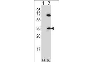 Western blot analysis of CDCA8 (arrow) using rabbit polyclonal CDCA8 Antibody (N-term) (ABIN656687 and ABIN2845924). (CDCA8 anticorps  (N-Term))