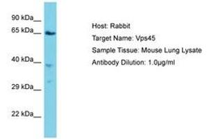 Image no. 1 for anti-Vacuolar Protein Sorting 45 (VPS45) (AA 468-517) antibody (ABIN6750334) (VPS45 anticorps  (AA 468-517))