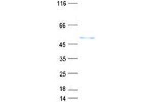 Validation with Western Blot