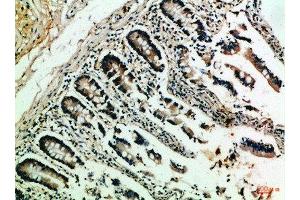 Immunohistochemical analysis of paraffin-embedded Human-colon, antibody was diluted at 1:100 (NFAT1 anticorps  (AA 640-700))