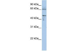 WB Suggested Anti-DLAT Antibody Titration:  0. (DLAT anticorps  (C-Term))