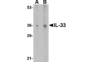 Western blot analysis of IL-33 in human lymph node tissue lysate with AP30426PU-N IL-33 antibody at (A) 1 and (B) 2 μg/ml. (IL-33 anticorps  (N-Term))