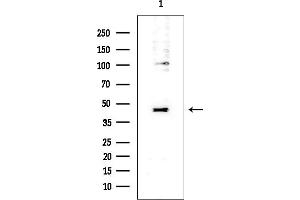 Western blot analysis of lysates from EC304 cells, using PRAS40 Mouse Monoclonal Antibody at 1/1000 dilution.