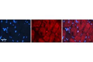 Rabbit Anti-Six1 Antibody    Formalin Fixed Paraffin Embedded Tissue: Human Adult heart  Observed Staining: Cytoplasmic,Nuclear (very rare in Nuclear) Primary Antibody Concentration: 1:600 Secondary Antibody: Donkey anti-Rabbit-Cy2/3 Secondary Antibody Concentration: 1:200 Magnification: 20X Exposure Time: 0. (SIX Homeobox 1 anticorps  (N-Term))