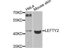 Western blot analysis of extracts of various cells, using LEFTY2 antibody. (LEFTY2 anticorps)