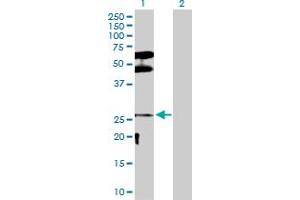 Western Blot analysis of DLX3 expression in transfected 293T cell line by DLX3 MaxPab polyclonal antibody. (DLX3 anticorps  (AA 1-287))