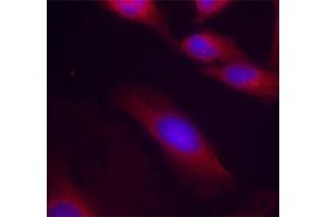 Immunofluorescence staining of methanol-fixed HeLa cells using Phospho-RELA-S536 antibody (ABIN2987368). (NF-kB p65 anticorps  (pSer536))