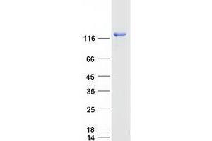 Validation with Western Blot