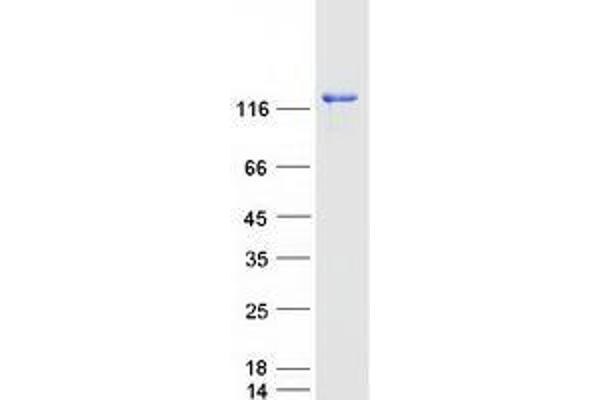 USP25 Protein (Myc-DYKDDDDK Tag)