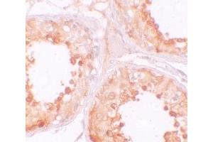Immunohistochemistry (IHC) image for anti-Y Box Binding Protein 2 (YBX2) (C-Term) antibody (ABIN1030807)