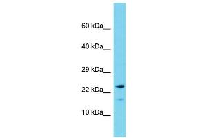 Host: Rabbit Target Name: CNIH2 Sample Type: Fetal Liver lysates Antibody Dilution: 1.