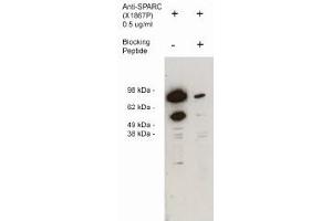 Image no. 1 for anti-Secreted Protein, Acidic, Cysteine-Rich (Osteonectin) (SPARC) antibody (ABIN265179) (SPARC anticorps)