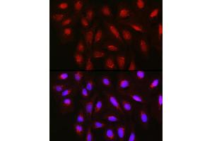 Immunofluorescence analysis of U2OS cells using TET3 Rabbit pAb (ABIN6133174, ABIN6149021, ABIN6149023 and ABIN6223527) at dilution of 1:150 (40x lens).