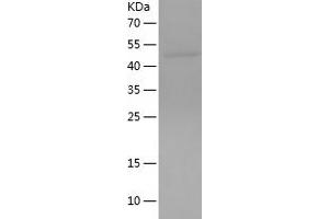 Western Blotting (WB) image for Interleukin 1 Receptor-Like 2 (IL1RL2) (AA 20-285) protein (His-IF2DI Tag) (ABIN7123527)